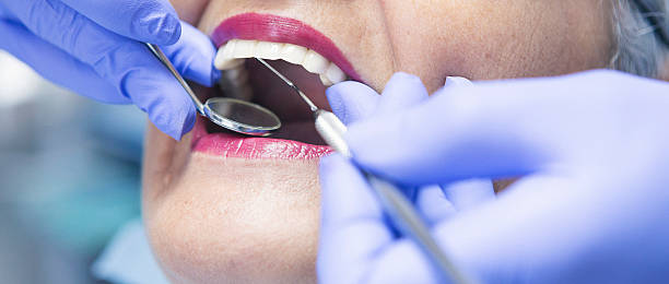 Best Knocked-Out Tooth (Avulsed Tooth) Treatment in Buhl, MN